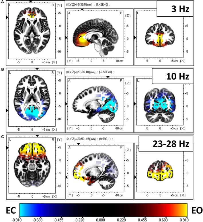 https://cdn.ncbi.nlm.nih.gov/pmc/blobs/dd61/4064566/8a0929560192/fnhum-08-00448-g0006.jpg