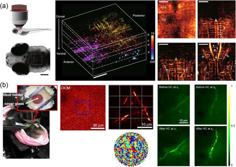 https://cdn.ncbi.nlm.nih.gov/pmc/blobs/dd61/9587606/af28a7506762/40824_2022_303_Fig13_HTML.jpg
