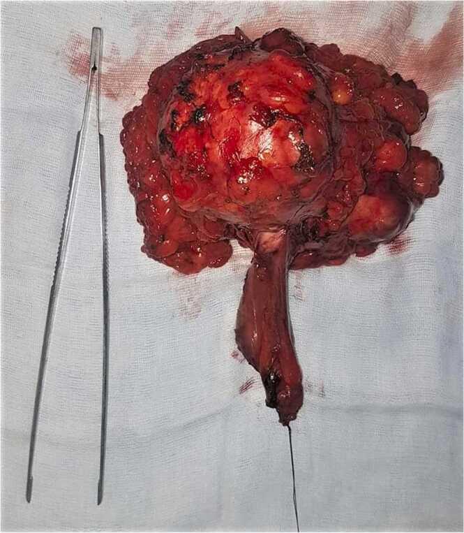 https://cdn.ncbi.nlm.nih.gov/pmc/blobs/dd62/8866152/a621c7243c23/gr3.jpg