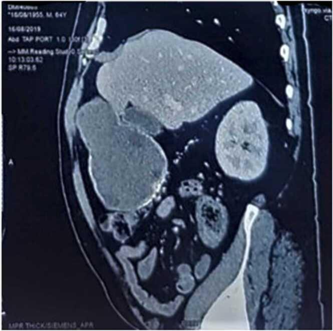 https://cdn.ncbi.nlm.nih.gov/pmc/blobs/dd62/8866152/fcef6ed8e149/gr1.jpg