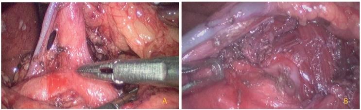 https://cdn.ncbi.nlm.nih.gov/pmc/blobs/dd63/8728423/3a41e89f72fd/gr4.jpg