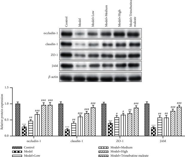 https://cdn.ncbi.nlm.nih.gov/pmc/blobs/dd69/8594983/7fbefb48086b/ECAM2021-5792130.002.jpg