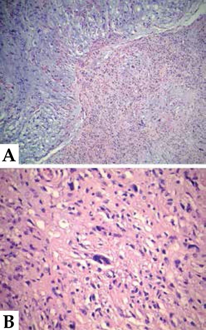 https://cdn.ncbi.nlm.nih.gov/pmc/blobs/dd6c/4782656/725988ceca57/abd-91-01-0097-g03.jpg