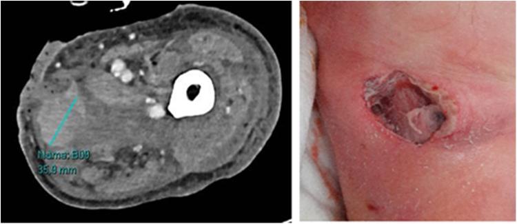 https://cdn.ncbi.nlm.nih.gov/pmc/blobs/dd6f/12055108/5751e3bbad87/ms9-87-2987-g002.jpg