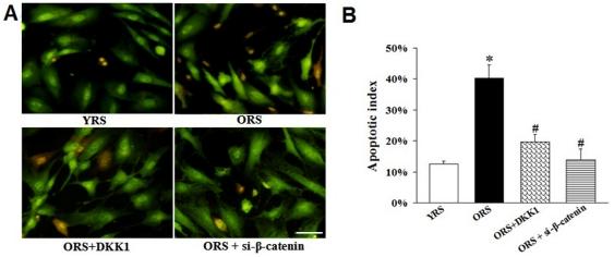https://cdn.ncbi.nlm.nih.gov/pmc/blobs/dd73/3119703/25c546f0af75/pone.0021397.g010.jpg