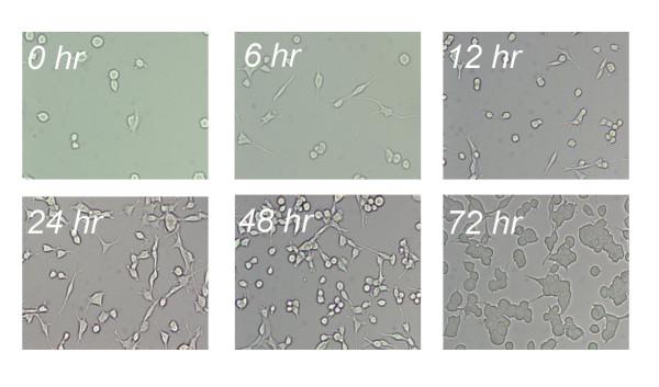 https://cdn.ncbi.nlm.nih.gov/pmc/blobs/dd7a/1373622/0764ef6b8be6/1477-3163-5-5-4.jpg