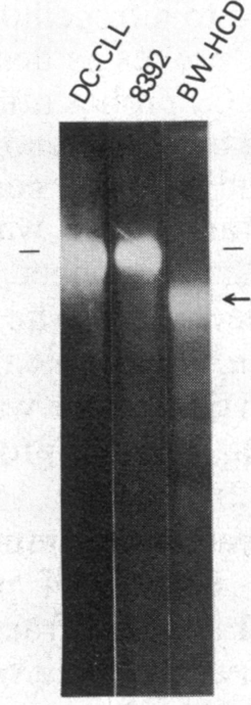 https://cdn.ncbi.nlm.nih.gov/pmc/blobs/dd85/323365/f187f58a11c2/pnas00312-0416-e.jpg