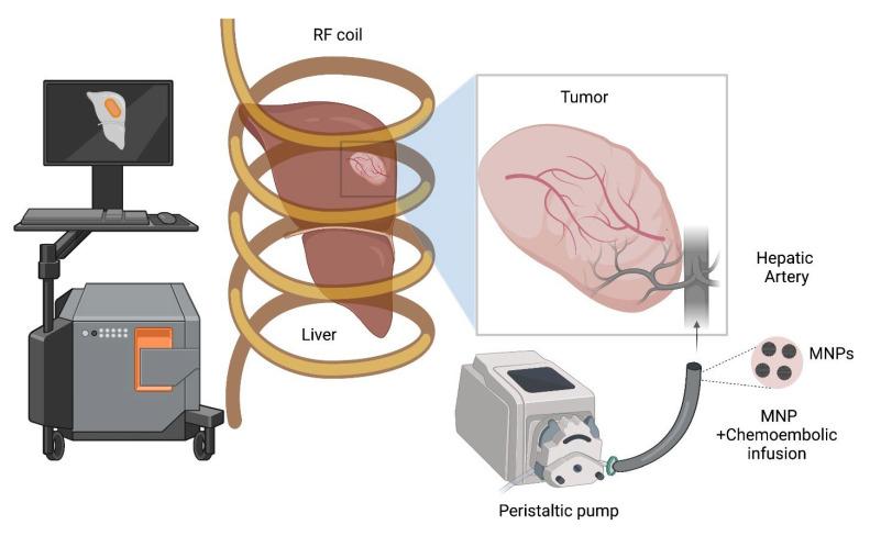 https://cdn.ncbi.nlm.nih.gov/pmc/blobs/dd8a/9414548/222f49b28fc1/nanomaterials-12-02768-g001.jpg