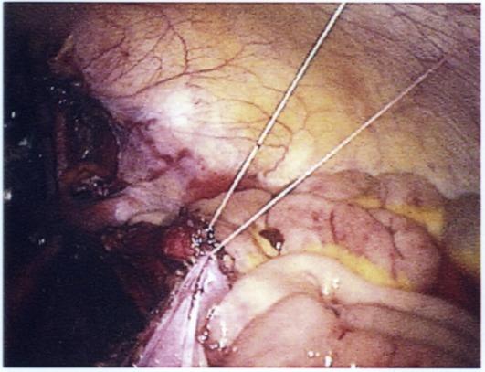 https://cdn.ncbi.nlm.nih.gov/pmc/blobs/dd8d/6113969/fd06c2aa0221/GMIT-6-51-g002.jpg