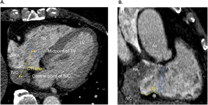 https://cdn.ncbi.nlm.nih.gov/pmc/blobs/dd96/12314311/a95e0730f6a7/JOA3-41-e70159-g002.jpg