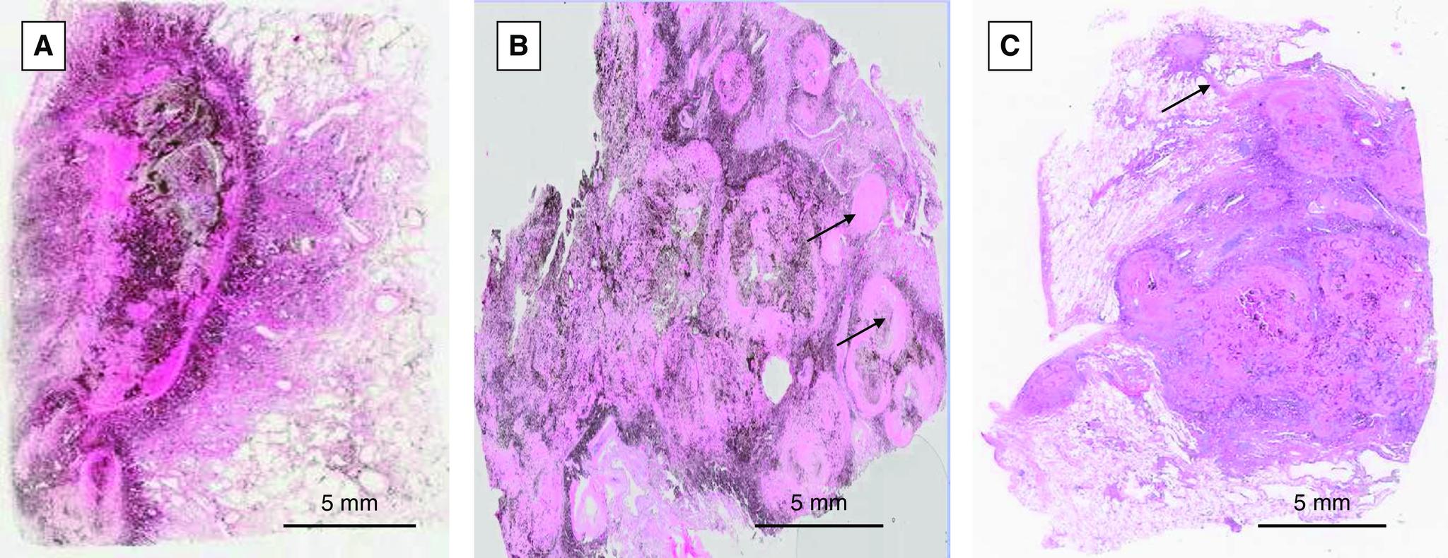 https://cdn.ncbi.nlm.nih.gov/pmc/blobs/dd9a/9447385/2c10189114da/AnnalsATS.202109-1064OCf2.jpg