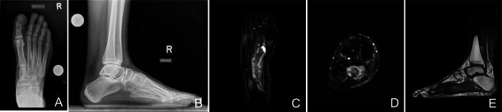 https://cdn.ncbi.nlm.nih.gov/pmc/blobs/dda8/10958242/233abfdf51fe/EOR-23-0193fig1.jpg
