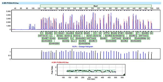 https://cdn.ncbi.nlm.nih.gov/pmc/blobs/dda8/5779872/68ab7039e26d/MMR-16-06-7915-g01.jpg