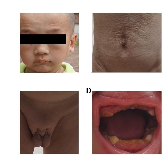 https://cdn.ncbi.nlm.nih.gov/pmc/blobs/dda8/5779872/f0358de0adba/MMR-16-06-7915-g00.jpg
