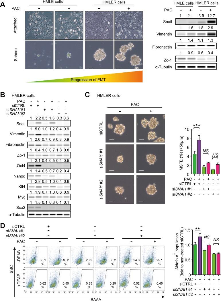 https://cdn.ncbi.nlm.nih.gov/pmc/blobs/ddae/4741946/dffc0c049b98/oncotarget-06-37526-g005.jpg