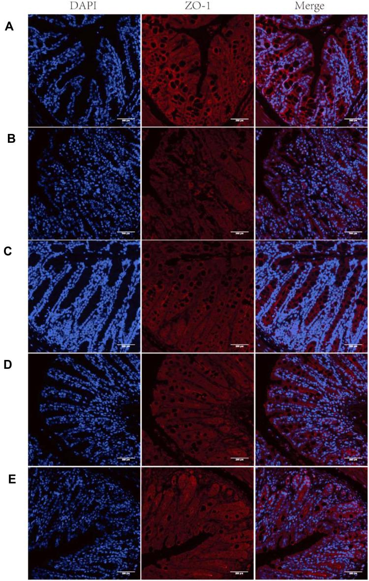 https://cdn.ncbi.nlm.nih.gov/pmc/blobs/ddae/7280064/066fac0d5b06/IJN-15-3937-g0008.jpg