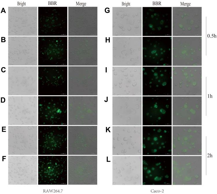 https://cdn.ncbi.nlm.nih.gov/pmc/blobs/ddae/7280064/3f4605931ca8/IJN-15-3937-g0005.jpg