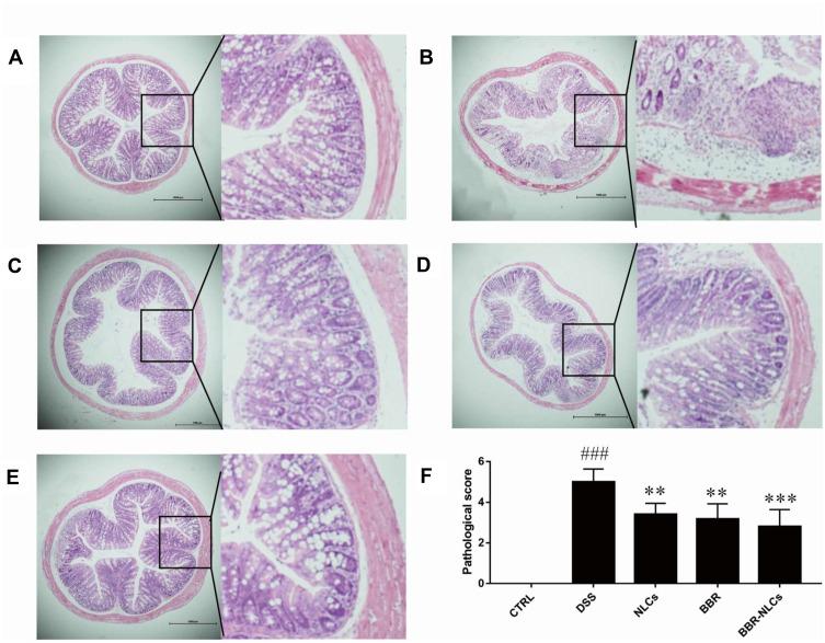 https://cdn.ncbi.nlm.nih.gov/pmc/blobs/ddae/7280064/5ac880fef9ac/IJN-15-3937-g0007.jpg