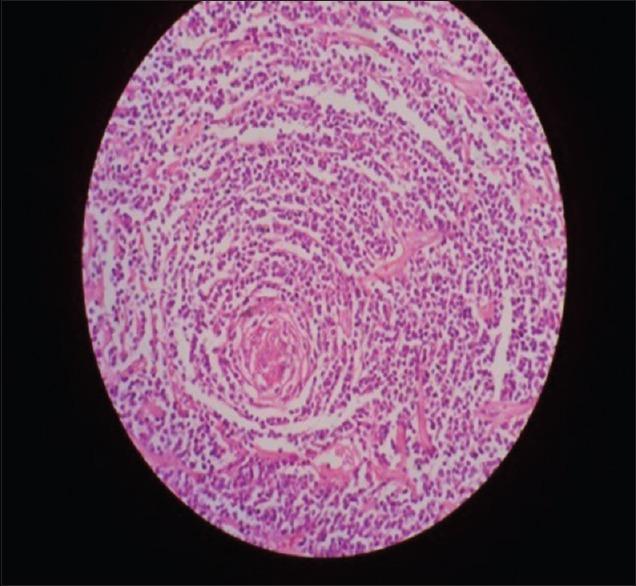 https://cdn.ncbi.nlm.nih.gov/pmc/blobs/ddb3/6259290/6c461c63c932/IJABMR-8-259-g002.jpg