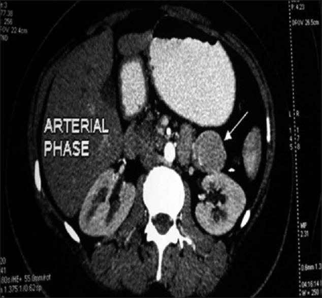 https://cdn.ncbi.nlm.nih.gov/pmc/blobs/ddb3/6259290/a497d1745ac3/IJABMR-8-259-g001.jpg