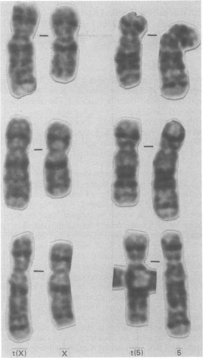 https://cdn.ncbi.nlm.nih.gov/pmc/blobs/ddb6/1015597/e57f0d945178/jmedgene00055-0022-a.jpg