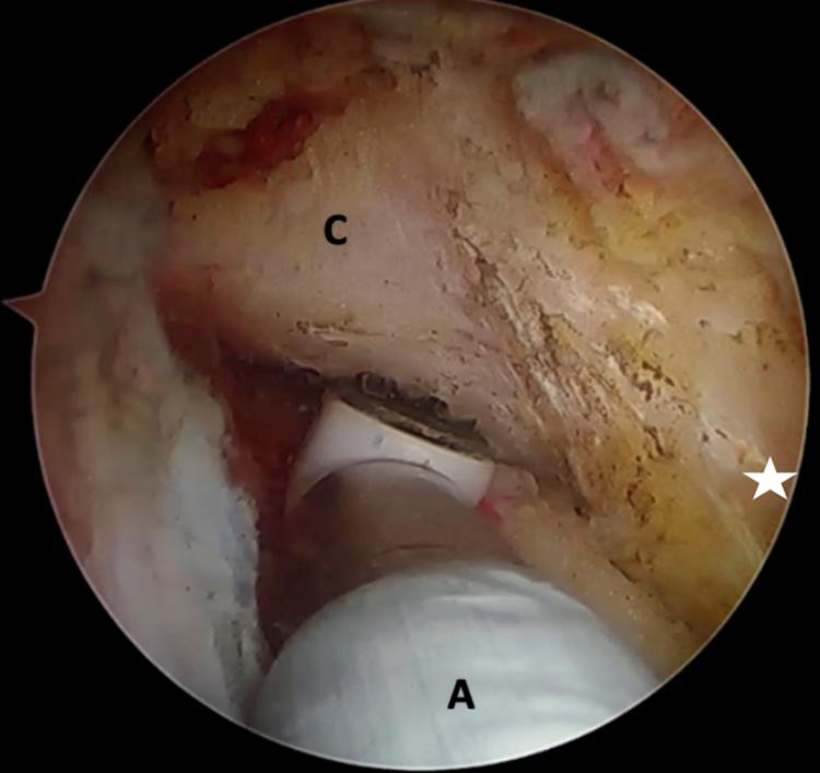 https://cdn.ncbi.nlm.nih.gov/pmc/blobs/ddba/7587229/d5c75ccc2aad/gr4.jpg