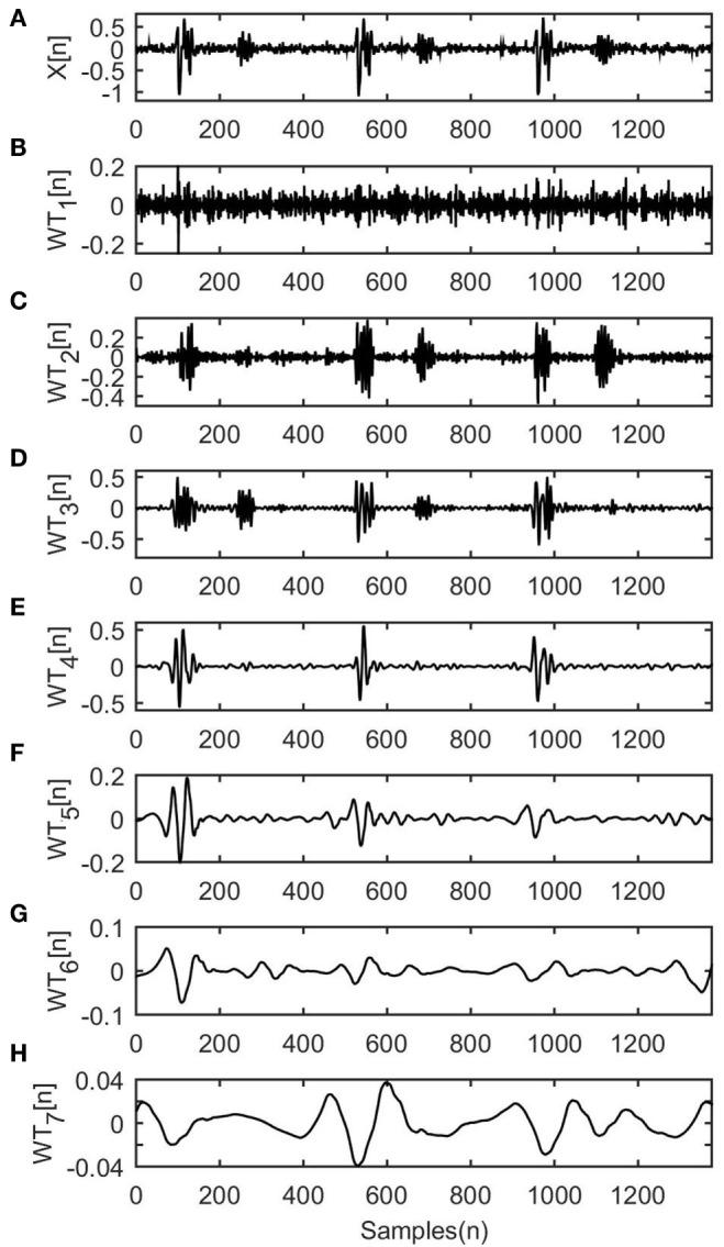 https://cdn.ncbi.nlm.nih.gov/pmc/blobs/ddc2/5596097/85ee400d0860/fbioe-05-00049-g001.jpg