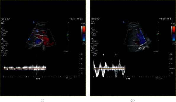 https://cdn.ncbi.nlm.nih.gov/pmc/blobs/ddc3/8967548/dd2af33c2481/CRIGM2022-5090200.001.jpg