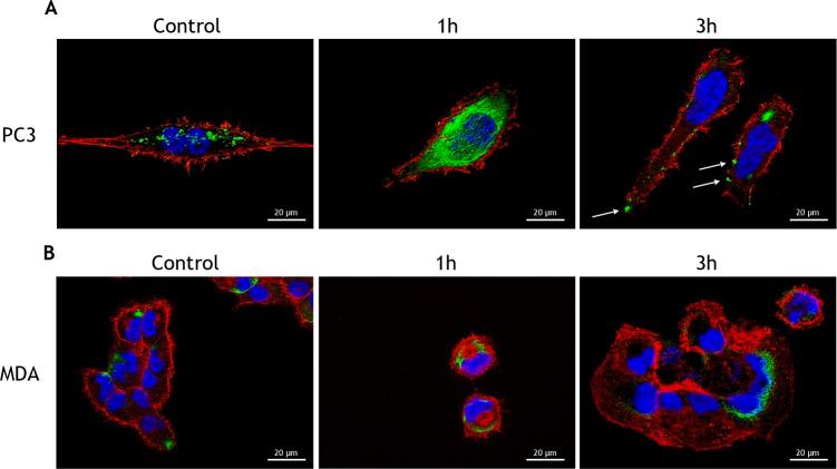 https://cdn.ncbi.nlm.nih.gov/pmc/blobs/ddca/5620189/52e31e041af9/oncotarget-08-67506-g003.jpg