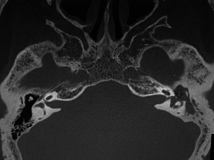 https://cdn.ncbi.nlm.nih.gov/pmc/blobs/ddd3/5115149/92d9490de1ec/ceo-2015-01662f2.jpg