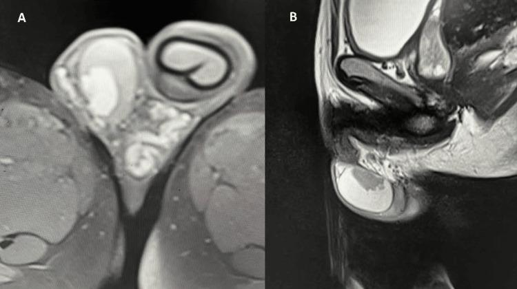 https://cdn.ncbi.nlm.nih.gov/pmc/blobs/ddd4/12228947/655ba864936b/cureus-0017-00000085320-i02.jpg