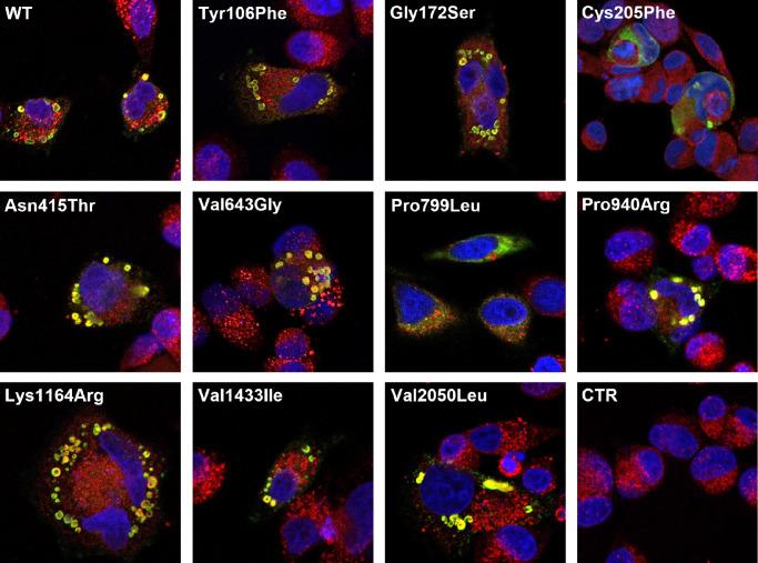 https://cdn.ncbi.nlm.nih.gov/pmc/blobs/ddd8/11305421/a0de29bca16e/iovs-65-10-2-f003.jpg