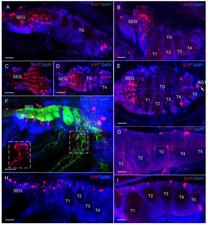 https://cdn.ncbi.nlm.nih.gov/pmc/blobs/dde4/10813508/9381a2c6af3c/biology-13-00035-g007.jpg