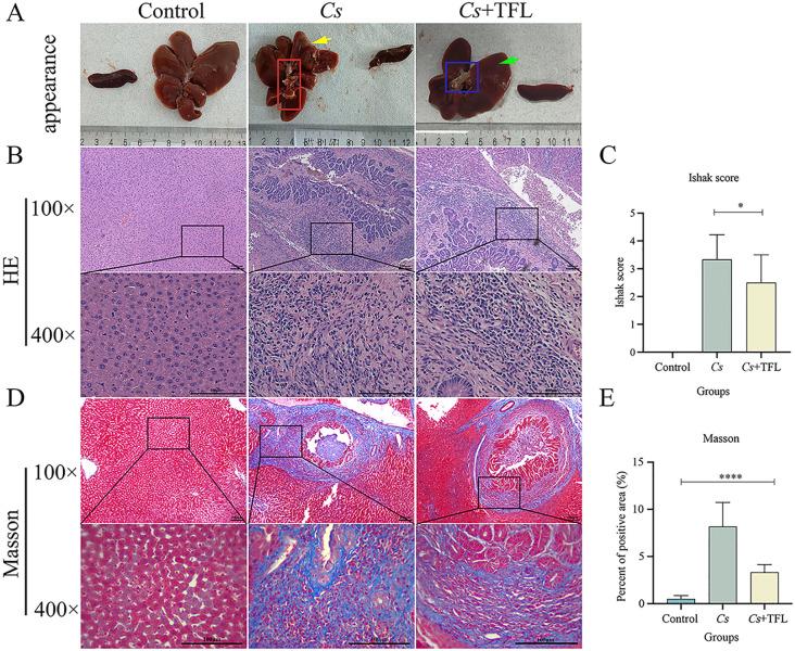 https://cdn.ncbi.nlm.nih.gov/pmc/blobs/ddf1/12343252/26f20f94df58/fcimb-15-1625004-g004.jpg