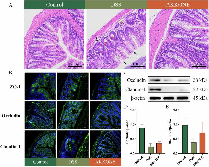 https://cdn.ncbi.nlm.nih.gov/pmc/blobs/ddf2/11576909/47a2ac8f4a19/41538_2024_339_Fig2_HTML.jpg