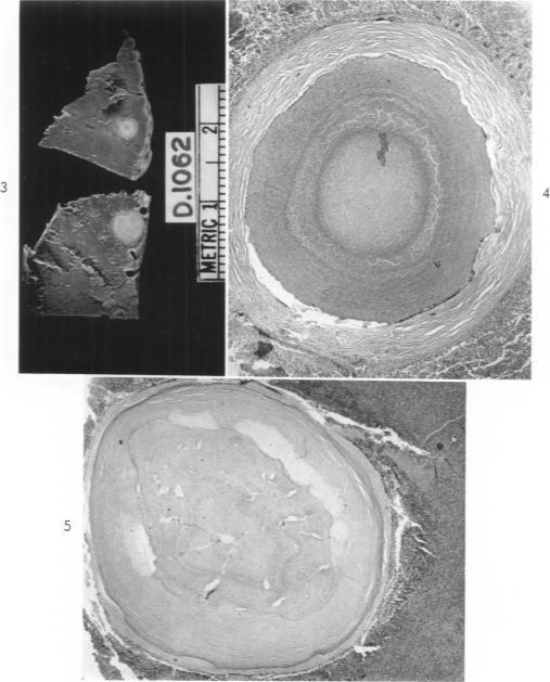 https://cdn.ncbi.nlm.nih.gov/pmc/blobs/ddf5/1942429/5d4fde77af93/amjpathol00336-0101-a.jpg