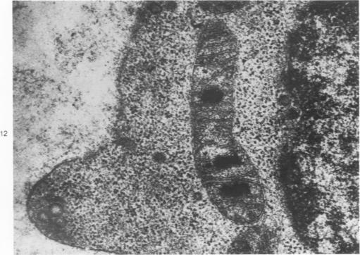 https://cdn.ncbi.nlm.nih.gov/pmc/blobs/ddfc/2018208/1bee064090c1/amjpathol00739-0192-b.jpg
