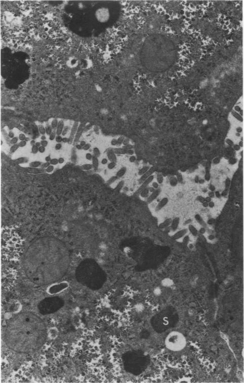 https://cdn.ncbi.nlm.nih.gov/pmc/blobs/ddfc/2018208/c367a3b860b0/amjpathol00739-0189-a.jpg
