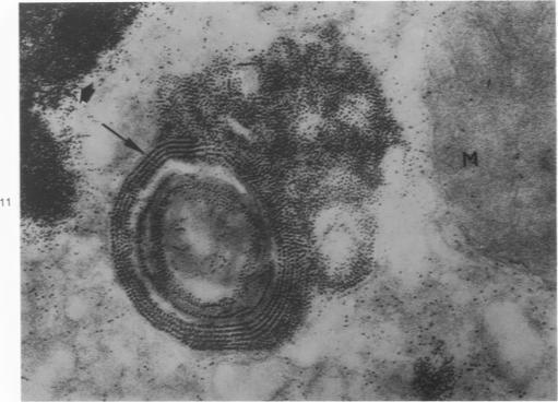 https://cdn.ncbi.nlm.nih.gov/pmc/blobs/ddfc/2018208/de2d10f3a0d2/amjpathol00739-0192-a.jpg
