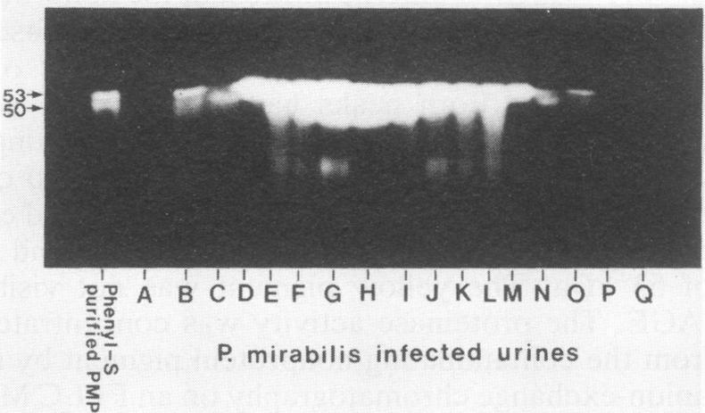 https://cdn.ncbi.nlm.nih.gov/pmc/blobs/ddfe/257153/eaef6dd7d86f/iai00030-0136-a.jpg