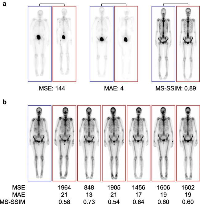https://cdn.ncbi.nlm.nih.gov/pmc/blobs/ddff/12119683/9b904f656ea5/259_2025_7091_Fig4_HTML.jpg