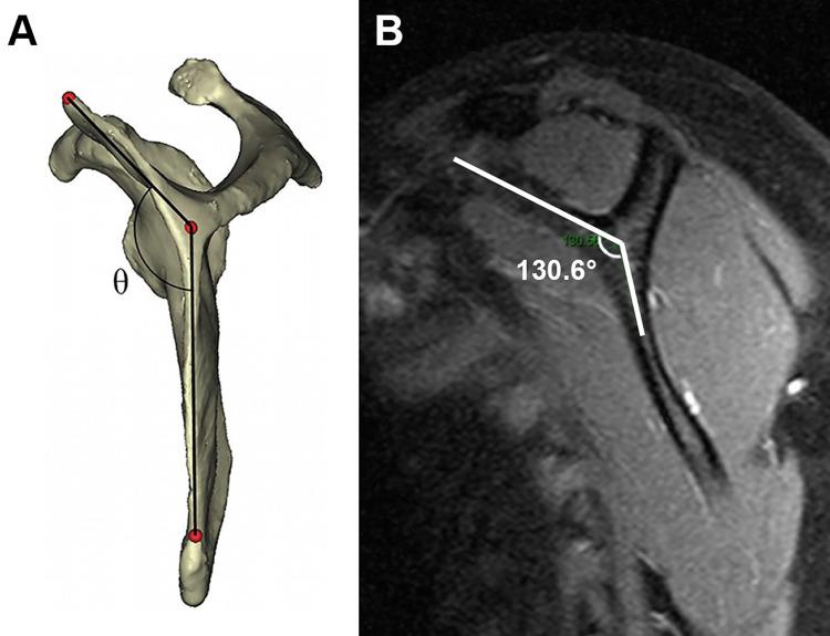 https://cdn.ncbi.nlm.nih.gov/pmc/blobs/de06/8085374/08b64790bc38/10.1177_2325967121998273-fig2.jpg