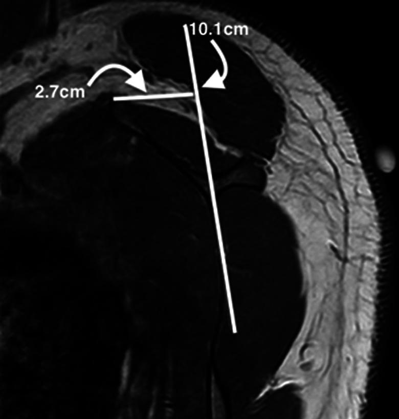 https://cdn.ncbi.nlm.nih.gov/pmc/blobs/de06/8085374/b178ce936759/10.1177_2325967121998273-fig1.jpg
