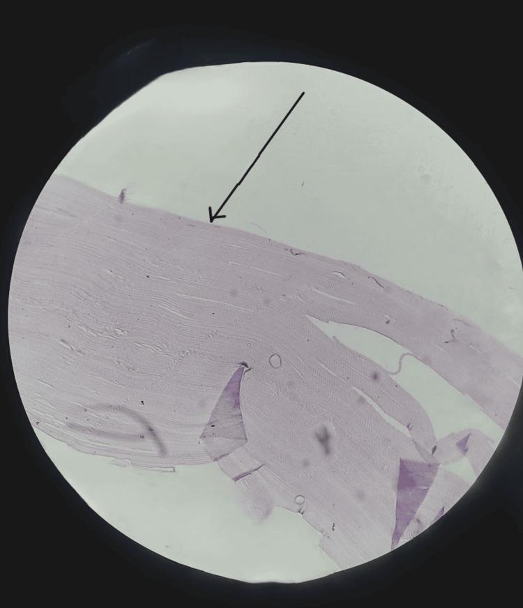 https://cdn.ncbi.nlm.nih.gov/pmc/blobs/de0a/11752074/d87c55f2f09f/cureus-0016-00000076243-i04.jpg
