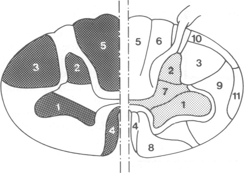https://cdn.ncbi.nlm.nih.gov/pmc/blobs/de0b/1014621/143a65e341a6/jnnpsyc00509-0041-a.jpg