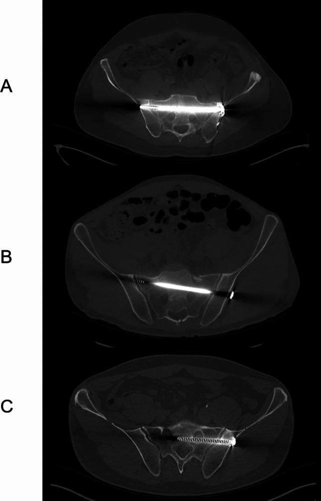 https://cdn.ncbi.nlm.nih.gov/pmc/blobs/de0d/12214010/25140699fe50/590_2025_4394_Fig2_HTML.jpg