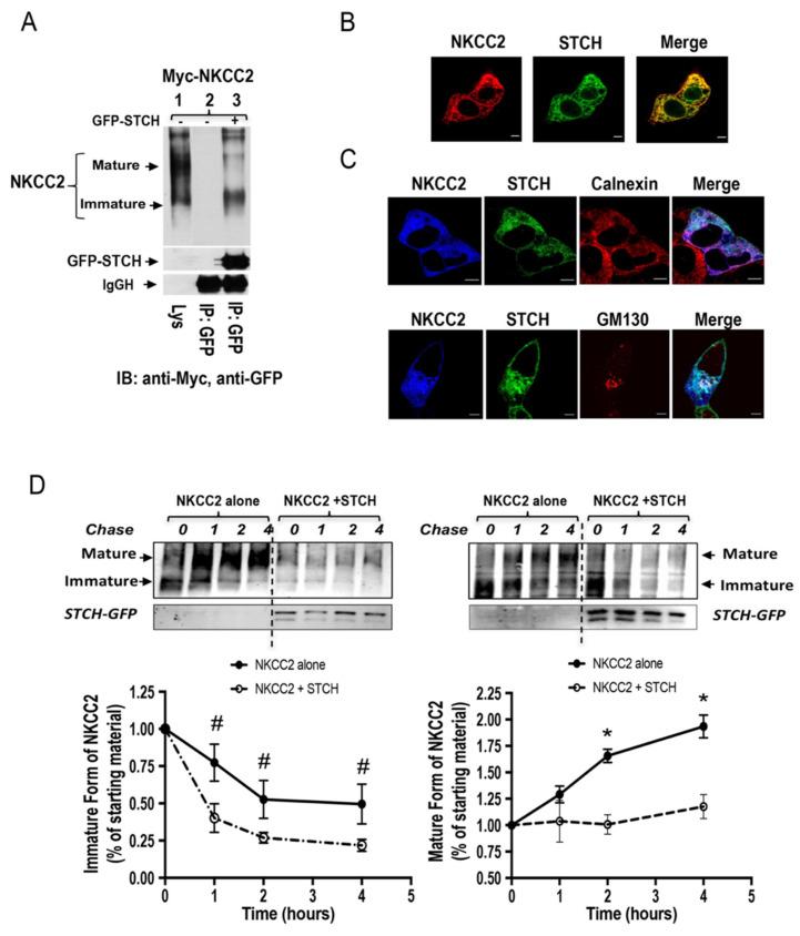 https://cdn.ncbi.nlm.nih.gov/pmc/blobs/de14/7926544/51e4a67cc886/ijms-22-02207-g004.jpg