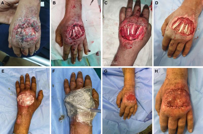 https://cdn.ncbi.nlm.nih.gov/pmc/blobs/de15/10817021/8eec96c88f77/gox-12-e5492-g002.jpg