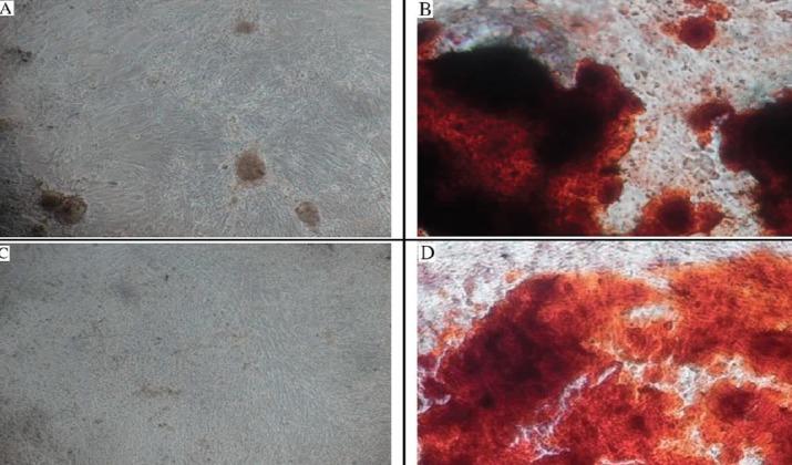 https://cdn.ncbi.nlm.nih.gov/pmc/blobs/de1b/6688306/ed3872e12710/AIM-27-72-g004.jpg