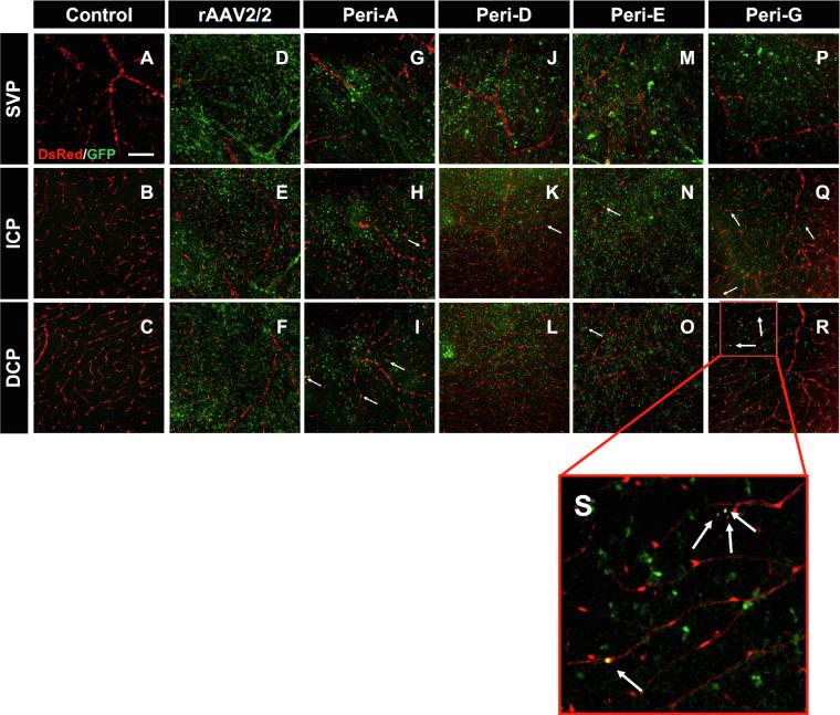 https://cdn.ncbi.nlm.nih.gov/pmc/blobs/de1b/9428359/42c074f0bef0/tvst-11-8-28-f004.jpg